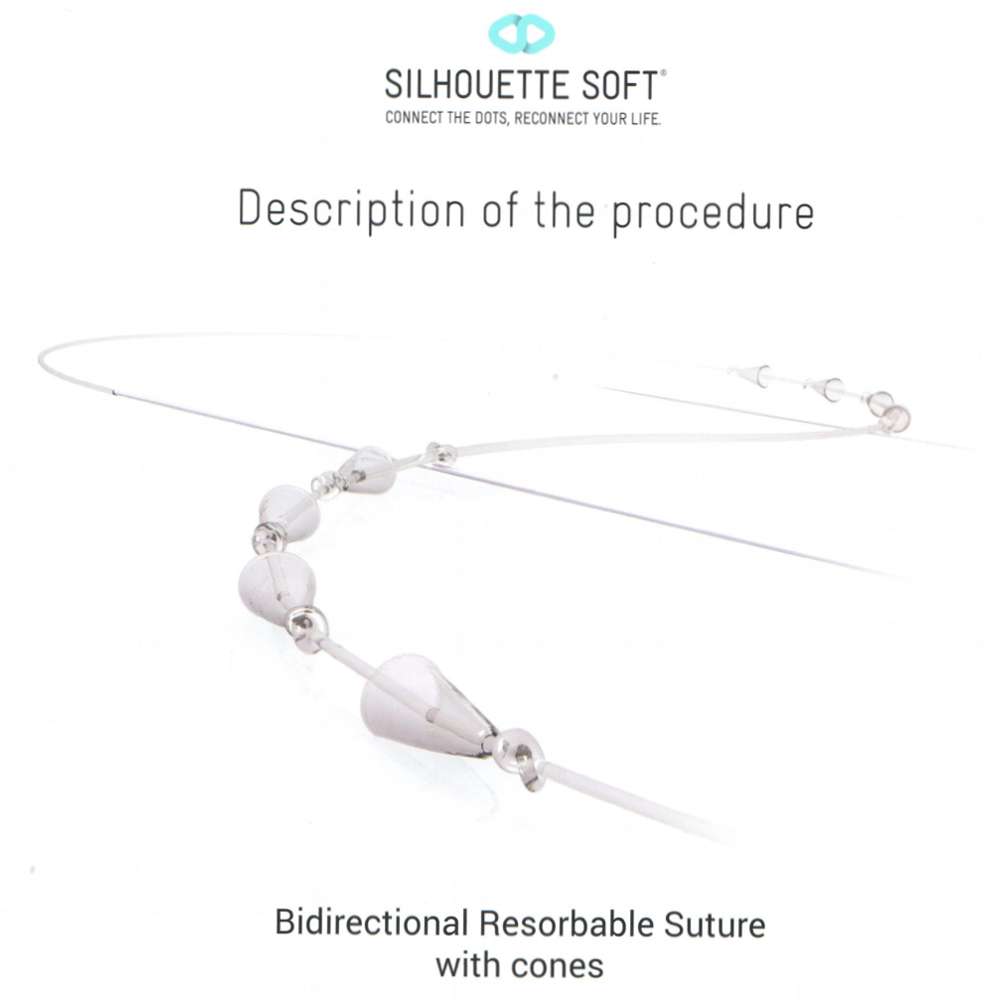 FACELIFTING ŠAVIMA – Silhouette soft lifting